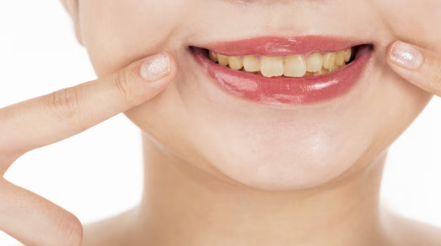 Gigi Kuning pada Ibu Hamil: Penyebab, Risiko, dan Cara Mengatasinya
